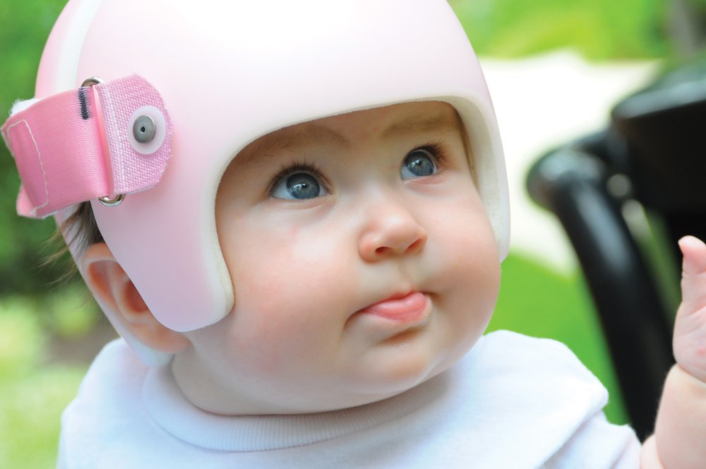 Infant wearing a cranial remolding helmet